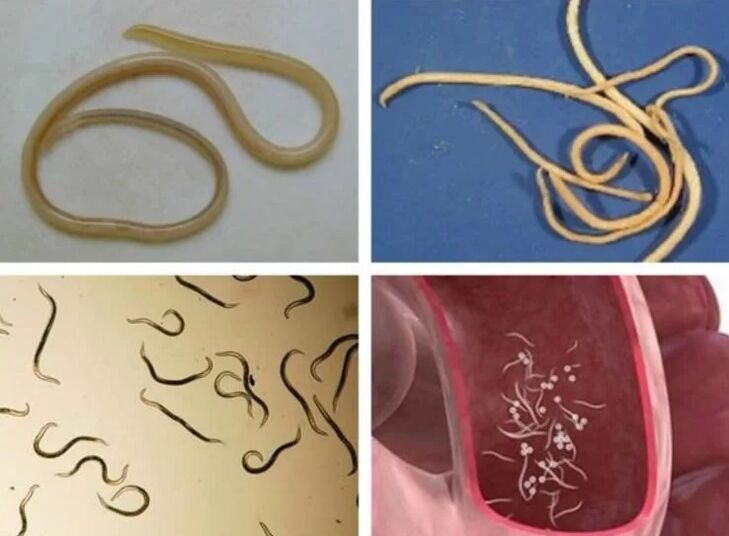 Helminths στους ανθρώπους
